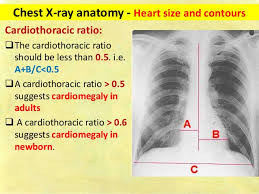 Chest X Ray Fundamentals