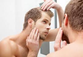 Hair fall that is caused by fluctuating testosterone levels is linked to both male and female pattern baldness. Hair Loss Causes Beauty Travels 24