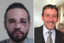 Record View: Little Isla Smith's story can inspire us to save a life  through blood donation