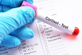 If your estrogen levels are low, it can result in weight gain. Cortisol Level Test Purpose Procedure And Results