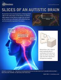 Has been added to your cart. New Research Finds Cell Damage In Autistic Brain Infographic Live Science