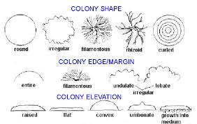 8 Bacterial Colony Morphology Biology Libretexts