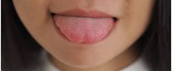 Image result for white cancer on tongue)