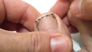 En cas de réutilisation des textes de cette page, voyez comment citer les auteurs et mentionner la licence. Comment Se Couper Les Ongles De Pied Pour Eviter Tout Ongle Incarne Youtube
