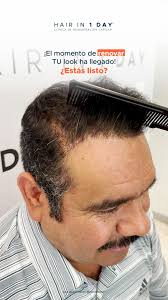 Solamente los expertos de Hair in 1 Day te darán la solución capilar para  que tomes impulso hacia tu mejor versión 🌟 , Porque no se trata solo de  recuperar tu cabello, es una transformación que ...