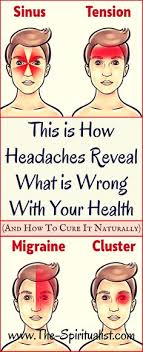 80 Best Headaches Chart Images In 2019 Headache Remedies