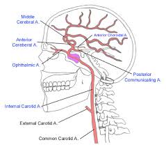 Image result for carotid artery