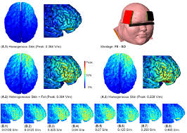 Predicted Electric Field On The Cortical Surface Due To F8