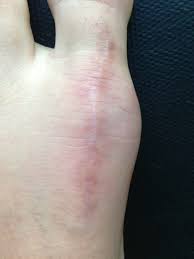 Pin On Health