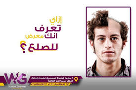 5 علامات تعرف من خلالها انك معرض للصلع Pictures From Everywhere Pictures Movie Posters Movies