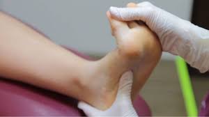 Image result for Out-toeing