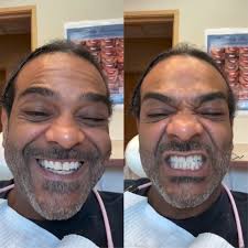 JimJones says veneers are not for him, he gets his teeth cleaned every 4  months and if you take care of your teeth you won't need veneers 🦷😳‼️