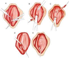Image result for Viscum littorum