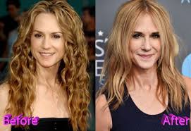 Jennifer jason leigh plastic surgery. Holly Hunter Plastic Surgery The Latest Talk Of The Town