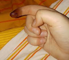 Langer weg in den beruf. Haarfarbe Von Der Haut Entfernen So Schnell Wie Moglich Hat Wer Tipps Haare Farbe Friseur