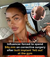 She's paid over $142,000 for cosmetic procedures! 😯