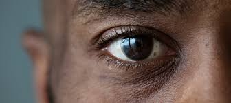 Eye Floaters? See Your Eye Doctor ...
