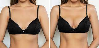 Breast Talk: All You Want To Know About Ideal Breasts 