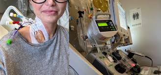 Image result for Apheresis