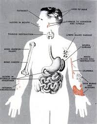 Pin By Cancer Me For You On Retro Scientiarum Radiation Therapy Radiation Radiologic Technology