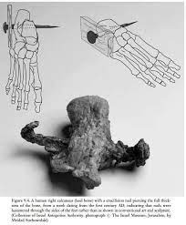 Nail Placement In Roman Crucifixion Roman Crucifixion Biblical Art Crucifixion