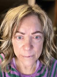 It's small business Friday and I cant contain the excitement of this  transformation. This isn't just lymphatic drainage. Take a look at my page  for more. Crystal Skin Co