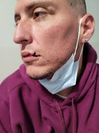 Fired Kent Co. deputy accused of assaulting paralyzed man