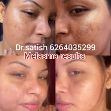 Dr-satish Nayak Patidar