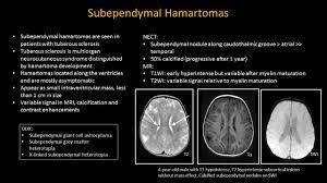 Residents and fellows contest rules | international ophthalmologists contest rules. Epos