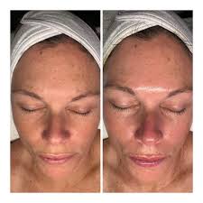 Perri Johnsen (@skinbyperrijohnsen) • Instagram photos and videos