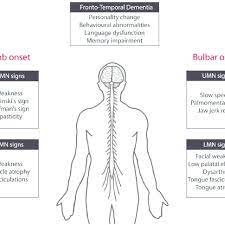 Limb Vs Bulbar Onset Infographic Personalized Medicine Memory Impairment Infographic