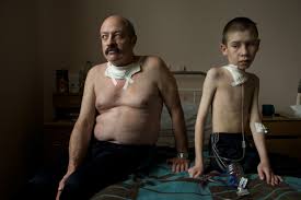 Chernobyl liquidators performed work under different conditions. A Long Look At The Effects Of The Chernobyl Disaster