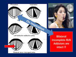 The glottis is the opening between the vocal folds (the rima glottidis). Larynx What To Know Dr S Parthasarathy Ppt Download