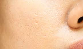 Kış aylarında havaların soğuması ile birlikte ortaya çıkan cilt kuruluğuna ne iyi gelir? Cilt Kuruluguna Ne Iyi Gelir Milat Gazetesi