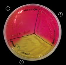 Salmonella shigella (ss) agar is moderately selective and differential medium for the isolation, cultivation and differentiation of salmonella spp. Mannitol Salt Agar Wikipedia