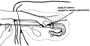 Artificial Insemination For Beef Cattle Cattle Ranching Beef Cattle Cattle Farming