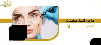 ما هي انواع عمليات التجميل ؟ - عيادات ماسترز الطبية