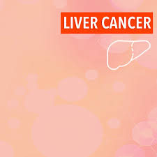 Primary liver cancer is a relatively rare disease in the united states, representing about 2% of all malignancies and 4% of newly diagnosed cancers. Overview Of Liver Cancers Cancerconnect