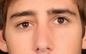 Orbitale Raumforderungen bei einem 23-jährigen Patienten