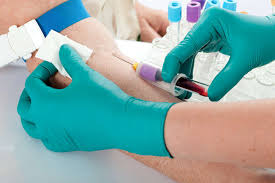 Ø tips for using reinforcement during blood draws. Tips For A Successful Blood Draw