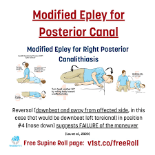 Image result for Canalith Repositioning Procedure