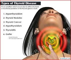 It is considered to be the most common cancer of the endocrine (hormone) system in your body and it represents about 3.8% of all new cancers cases in the united states (1). Thyroid Disease Types Causes Symptoms Treatment Prognosis Epidemiology Prevention