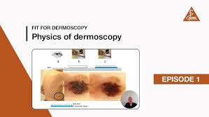 Image result for Dermoscopy