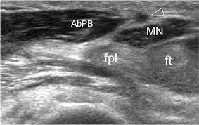 Delayed repair by advancement, free graft or direct suture. Epos Trade