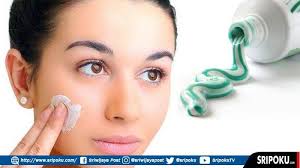 Ternyata Mengobati Jerawat Dengan Pasta Gigi Berbahaya Bagi Kulit Ini Penjelasan Ahli Dermatologi Sriwijaya Post