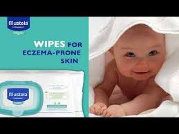 Luckily, using natural products like pure avocado oil can help. Stelatopia Wipes For Eczema Prone Skin Mustela Eczema Baby Skin Care Wipes