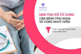 Theo hiệp hội ung thư mỹ, ước tính có khoảng 12.340 trường hợp ung thư cổ tử cung ở mỹ mỗi năm. Ung ThÆ° Cá»• Tá»­ Cung La Gi Co Chá»¯a Ä'Æ°á»£c Khong
