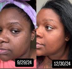 Mask-wearing products for 8-hour comfort at the YMC