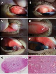 Check spelling or type a new query. Korean Journal Of Ophthalmology