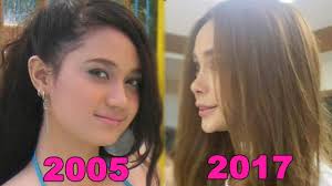 Arci muñoz is a filipina actress and singer. Arci Munoz Plastic Surgeries Through The Years Youtube